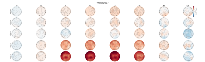 Average topographies of the theta band activity